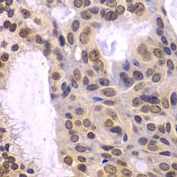 POLD3 Rabbit Polyclonal Antibody