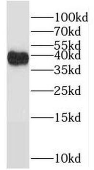 POLDIP2 Rabbit Polyclonal Antibody