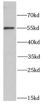 POLG2 Rabbit Polyclonal Antibody