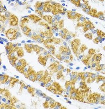 POLG2 Rabbit Polyclonal Antibody