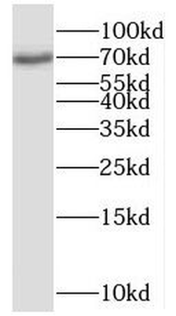POLK Rabbit Polyclonal Antibody