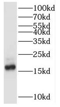 POLR2D Rabbit Polyclonal Antibody