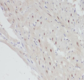 POLR2J Rabbit Polyclonal Antibody