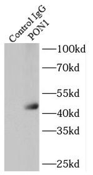 PON1 Antibody