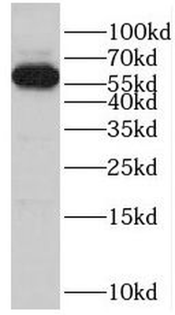 POTEH Rabbit Polyclonal Antibody
