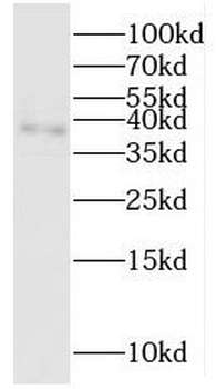 PPA2 Antibody