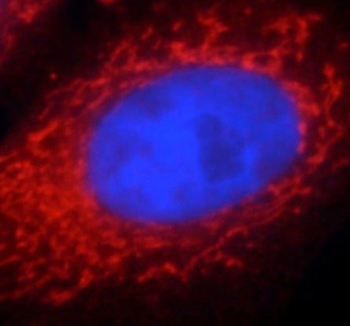 PPARG Rabbit Polyclonal Antibody