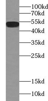 PPARA Rabbit Polyclonal Antibody