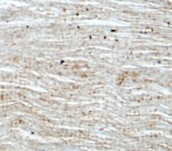 PPARA Rabbit Polyclonal Antibody