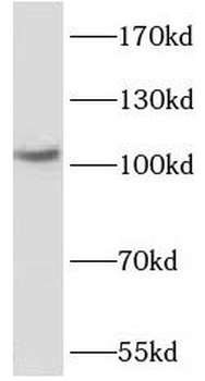 PPARGC1B Rabbit Polyclonal Antibody