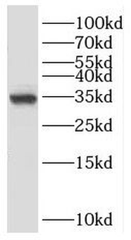 PPCS Rabbit Polyclonal Antibody