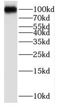 PPP1R10 Rabbit Polyclonal Antibody