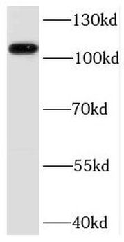 PPP1R13L Antibody