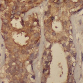 PPP1R13L Antibody