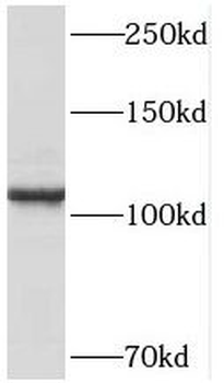 PPP1R13L Antibody