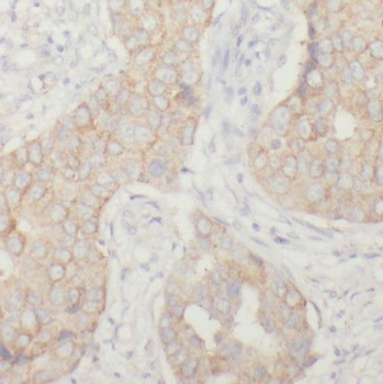 PPP1R13L Antibody