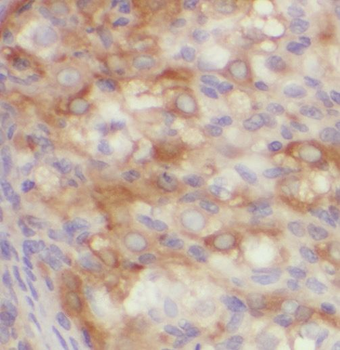 PPP1R15B Antibody