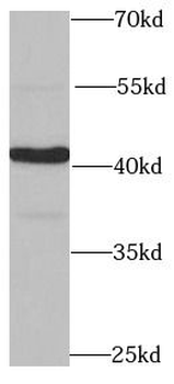 PPP1R8 Rabbit Polyclonal Antibody
