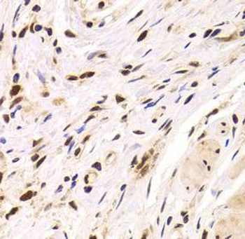 PPP1R8 Rabbit Polyclonal Antibody