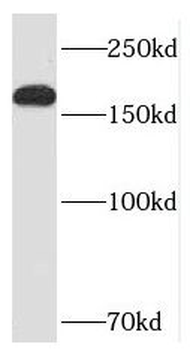 PPP1R9A Antibody