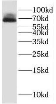 PPP2R1A Antibody