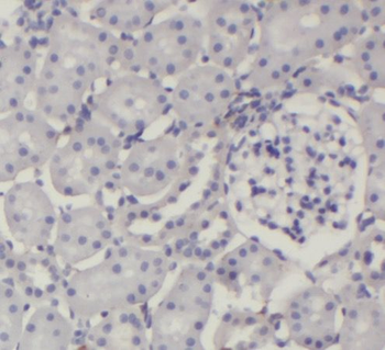 PPP2R1A Antibody