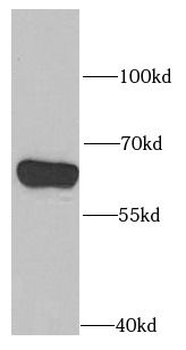 PPP2R1B Rabbit Polyclonal Antibody