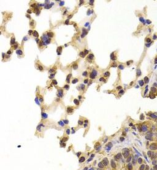 PPP2R1B Rabbit Polyclonal Antibody