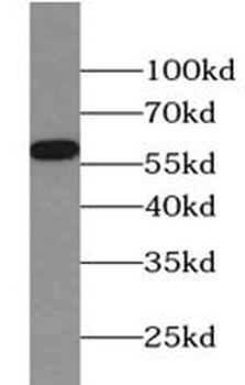 PPP3CA Antibody