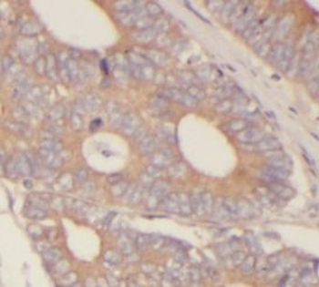 PPP3CA Antibody