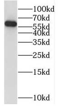 PPP3CB Rabbit Polyclonal Antibody