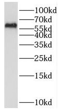 PPP3CB Rabbit Polyclonal Antibody