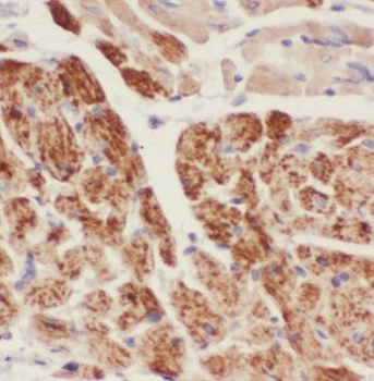 PPP3CB Rabbit Polyclonal Antibody