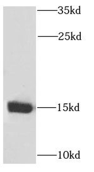 PPP3R1 Rabbit Polyclonal Antibody