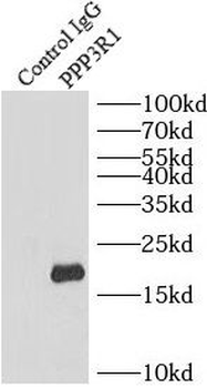PPP3R1 Rabbit Polyclonal Antibody