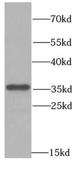PPP4C Rabbit Polyclonal Antibody