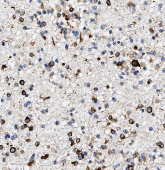 PPP5C Rabbit Polyclonal Antibody