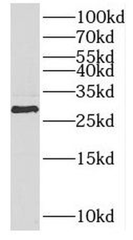 PPT2 Rabbit Polyclonal Antibody