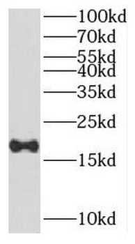 PRAP1 Rabbit Polyclonal Antibody