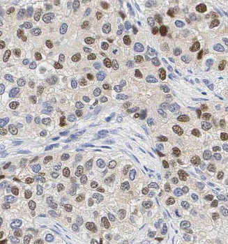 PRC1 Rabbit Polyclonal Antibody
