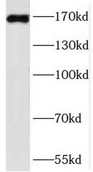 PRDM15 Rabbit Polyclonal Antibody