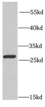 PRDX6 Rabbit Polyclonal Antibody