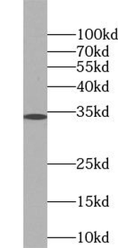 PRG2 Antibody