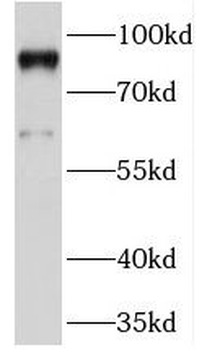 PRICKLE1 Rabbit Polyclonal Antibody