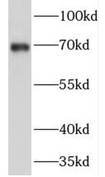 PRICKLE3 Rabbit Polyclonal Antibody