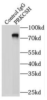 PRKCSH Antibody