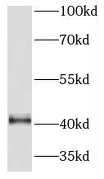 PRMT1 Rabbit Polyclonal Antibody