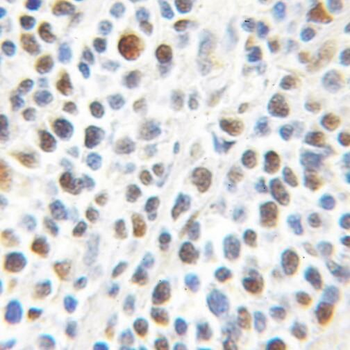 PRMT1 Rabbit Polyclonal Antibody