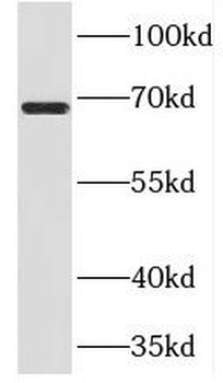 PRMT3 Rabbit Polyclonal Antibody