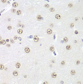 PRMT5 Rabbit Polyclonal Antibody